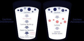 Image result for Lactase Deficiency