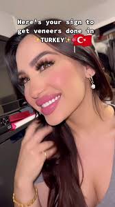 Worth it!! 👌🏽 #veneers #veneersturkey #dentalwork #turkeydental  #turkeydentist #teeth #porcelainveneers #emax #emaxveneers