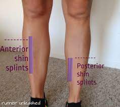 Running Without Injuries Why Do I Get Shin Splints Shin Splints Massage Therapy Running