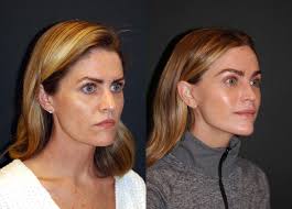 Dr. Andrew Jacono (@DrJacono)