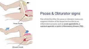 Image result for Obturator Sign