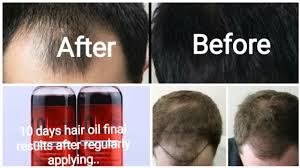 How i use the oil. 10 Days Hair Oil Review After Applying For 125 Days Continuously 3 Bottles Youtube