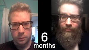 6 Month Beard Growth Time Lapse
