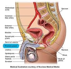 If you have been diagnosed with adenocarcinoma cancer, you have a cancer that developed in one of the glands that lines the inside of your organs. Newly Diagnosed Prostate Buddies