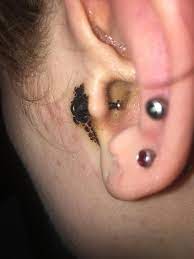 Hold the towel firmly against the area to thoroughly soak the piercing site. Should I Clean Bloody Tragus Is This Amount Of Dried Blood Normal Piercing