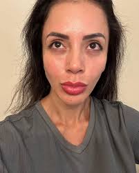 Jasmin From '90 Day Fiancé'S' Before And After Surgery