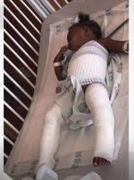 Baby Found With Second Degree Burns After Being Left Alone In Bathtub Man Facing Charges Whp