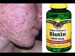 Biotin hair growth 5000 mcg Biotin Bad Breakouts Side Effects Youtube