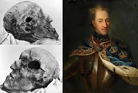 The head of Swedish king Charles XII, killed in 1718 by a projectile during  the siege of Fredriksten in Norway. The shot struck the left side of his  skull and exited on