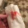 Soak and blot jeans to remove blood stains. 1
