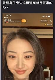 Đệ nhất mỹ nhân Bắc Kinh' Cảnh Điềm gây sốc với gương mặt khác lạ, cư dân  mạng nghi do di chứng của thẩm mỹ hỏng