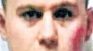 Aaron Rochford: Shocking pictures show horrific injuries of Drogheda kidnap  victim