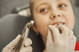 Leo Tooth Extractions