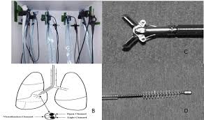 flexible fiberoptic bronchoscopy in pediatric practice