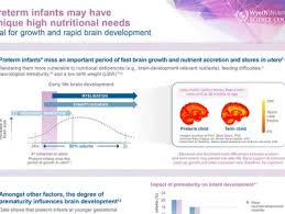 Image result for Preterm Infant Growth