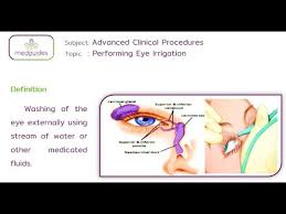 Image result for Eye Irrigation