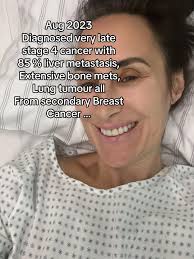 Longest Living Stage 4cancer