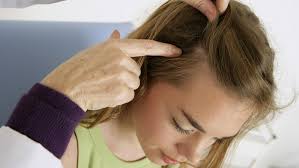 The main type of fungal infection on the scalp that can cause hair loss comes from a class of fungi called. How To Cure A Fungal Infection In My Head Quora