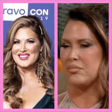 Emily's face. What happened? : r/rhoc