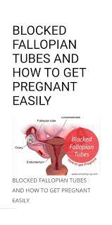 Check spelling or type a new query. Health Matters Blocked Fallopian Tubes Is One Of The Facebook