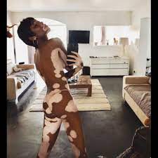 Instagram fotos virales: Modelo con vitíligo posa desnuda y manda  importante mensaje de aceptación [VIDEO] 