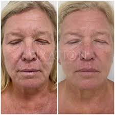 Fixation Skincare and Laser Clinic