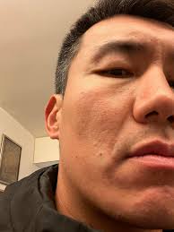 After seeing the dietician yesterday, we established where my problem areas  are with food. Lowering my cholesterol and losing body fat is the main goal  here. 4.2kg and 5-6% body fat needs