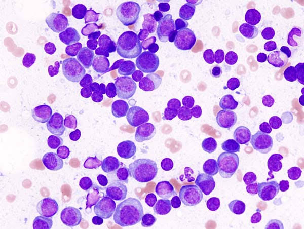 COMPREHENSIVE MYELOMA PROTEIN PANEL product image