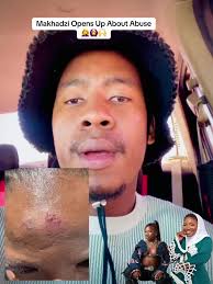Makhadzi Opens Up About Abuse Experiences