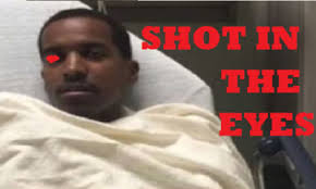 That's like saying lil durk is on. Lil Reese Blind In Left Eye Says Northwestern Doctors Why Lil Reese Snitched To The Cops Famelord