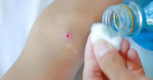 Image result for wolf spider bite skin