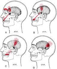 Will a muscle relaxer help a toothache. Toothache And Muscle Pain Treatment Tmj Tooth Pain Carolina Tmj