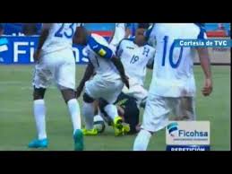Lesion que sufre luis garrido por consecuencia de un empuje que le hacen a javier aquino y cae sobre la pierna de garrido. Luis Garrido De Honduras Sufre Horrible Lesion En Juego Ante Mexico Youtube