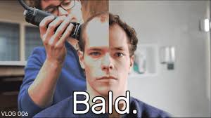 Going Bald to LOCK IN... 😮‍💨
