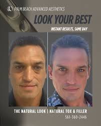 Palm Beach Advanced Aesthetics