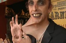 Meet Gary 'Stretch' Turner, the man with the world's stretchiest skin