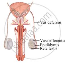 Each force arrow in the diagram is labeled to indicate the exact type of force. Draw A Label Diagram Draw A Labeled Diagram To Show The Interrelationship Of Four Accessory Ducts In A Human Male Reproductive System Biology Shaalaa Com