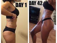 Your health before the surgery. Before Afters