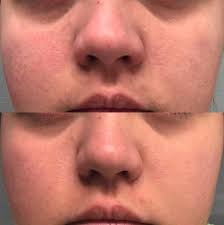 Check spelling or type a new query. 23 Products Designed To Help You Get A More Even Skin Tone