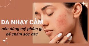 Da Nhạy Cảm Nên Dùng Mỹ Phẩm Gì? Những Lưu Ý "Quan Trọng" Nên Biết