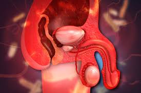 Image result for Varicocele