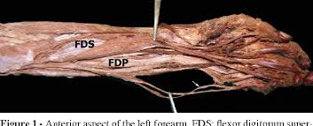 Zone is unique in that fdp and fds in same tendon sheath (both can be injured within the flexor retinaculum). Figure 1 From An Anomaly Of Flexor Muscles Of The Fifth Little Finger Of The Hand An Anatomical Case Report Semantic Scholar