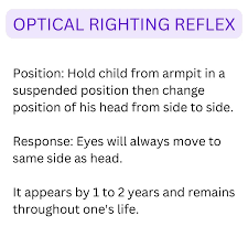 Image result for Optical Reflex