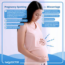 Bleeding during pregnancy may be normal (implantation bleeding) or it may be a sign of a more serious problem. Signs Of Miscarriage And Causes You Need To Be Aware Of
