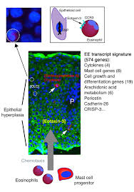 We did not find results for: Jci Eotaxin 3 And A Uniquely Conserved Gene Expression Profile In Eosinophilic Esophagitis