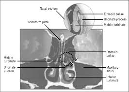 Coronal View Of The Anterior Cranial Fossa At The Level Of The Download Scientific Diagram