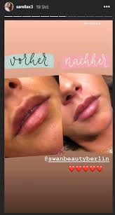 Sarah engels live in magdeburg. Sarah Lombardi Zeigt Ihren Beauty Eingriff Das Hat Sie Machen