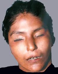 Houston, Texas Unidentified Hispanic Female NamUs #UP2632 Found August 12,  1985 Postmortem interval Hours Body condition Recognizable face Age  approximation 16