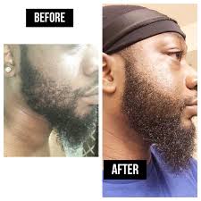 I'm your pusha baby. 😉 Yea I got that crin-aaackkk! Beard crack that is.  What you actually see here is pure BIOTIN which is one of the active  ingredients in my beard