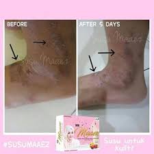 Testimoni susu maaez datang lagi! Susu Maaez Review Testimoni Susu Maez Harga Susu Maaez